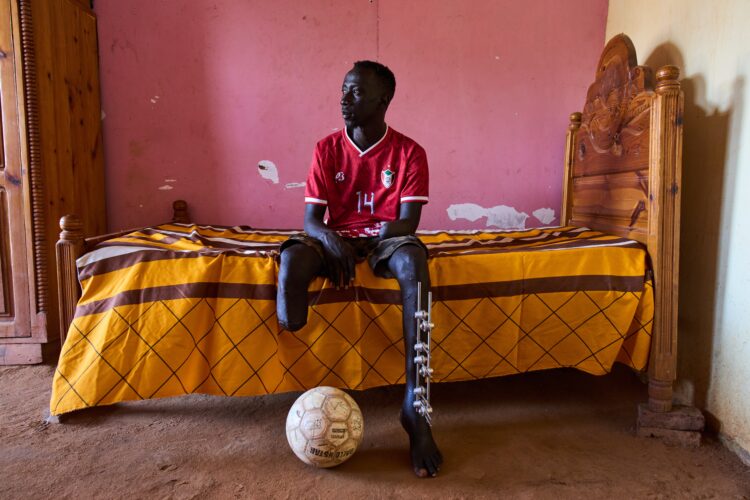 The scars of war among survivors in Sudan